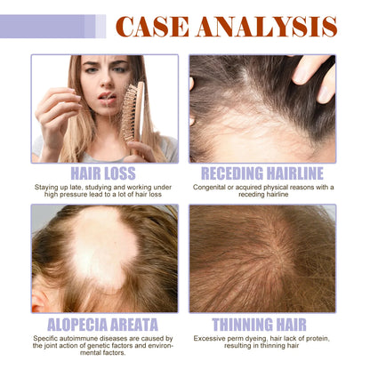 Dense Hair Supplement Drops with Vitamin B6